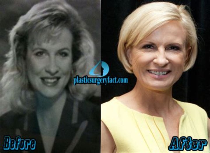 Has Mika Brzezinski Had Plastic Surgery? Body Measurements and More
