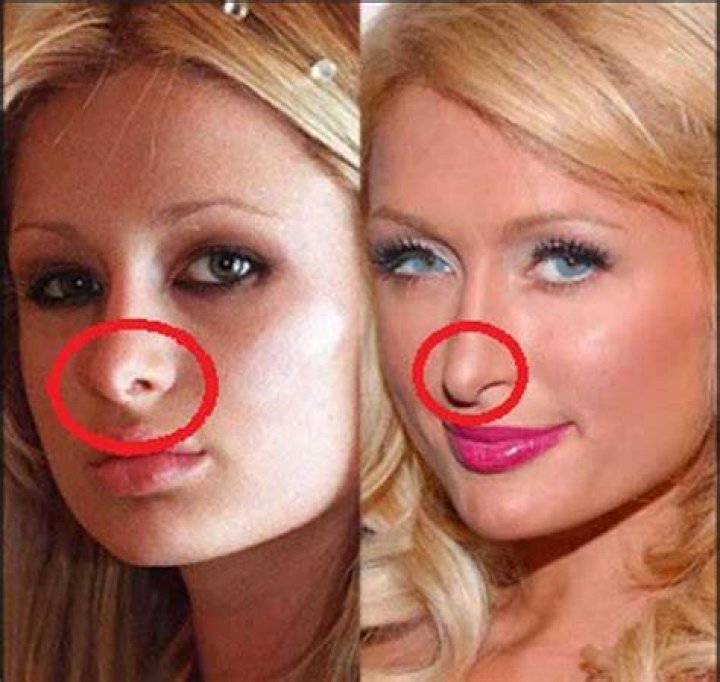 Paris Hilton Plastic Surgery Nose Job and Boob Job Before After